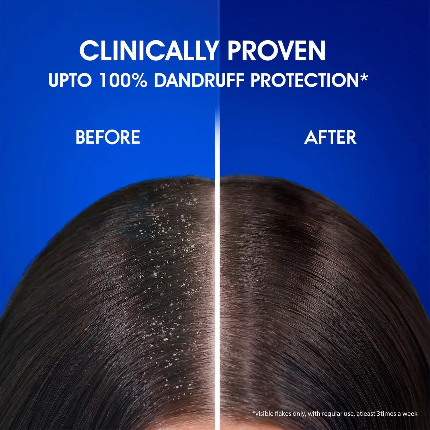 Head & Shoulders Anti Dandruff Shampoo Anti Hairfall-180ml thumbnail 3