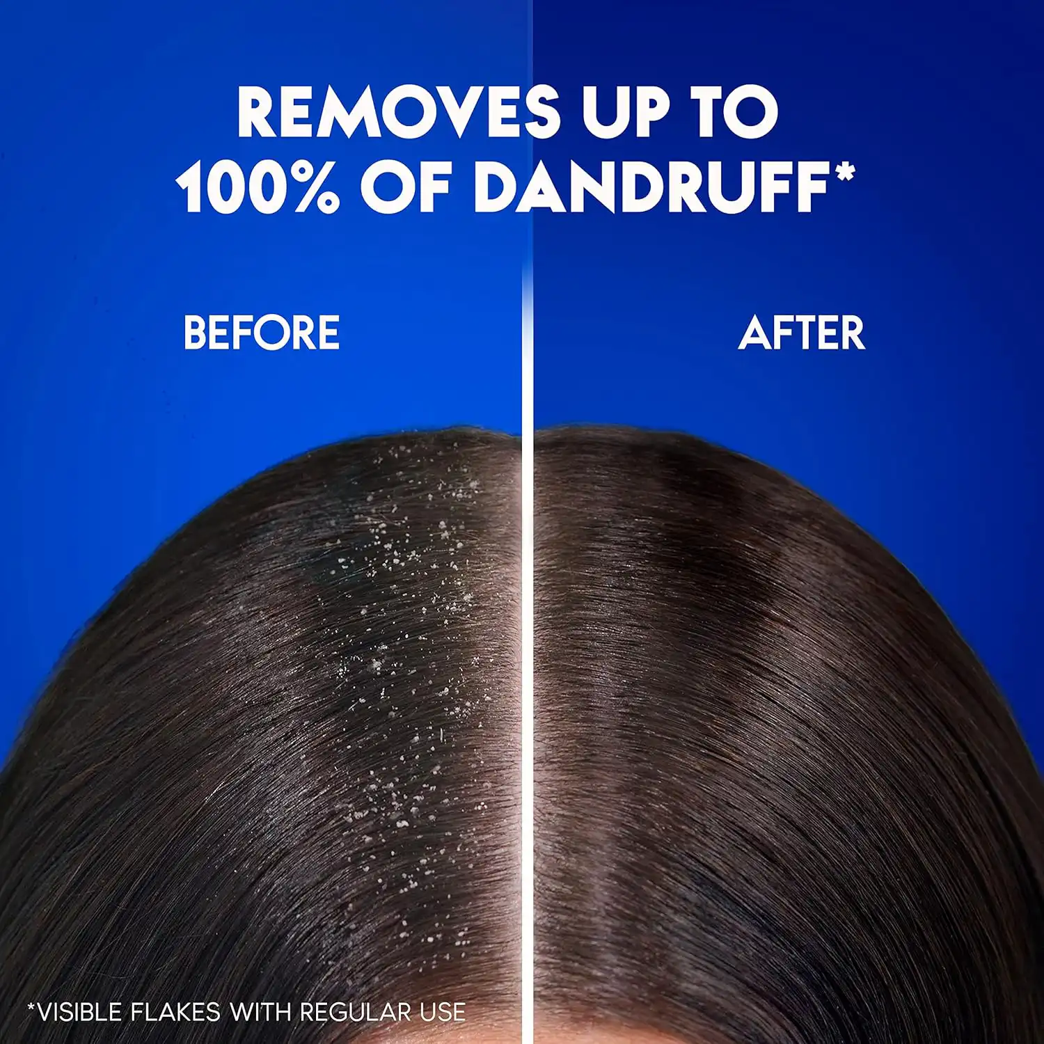 Head & Shoulders Anti Dandruff Shampoo Menthol Fresh-600ml thumbnail 4