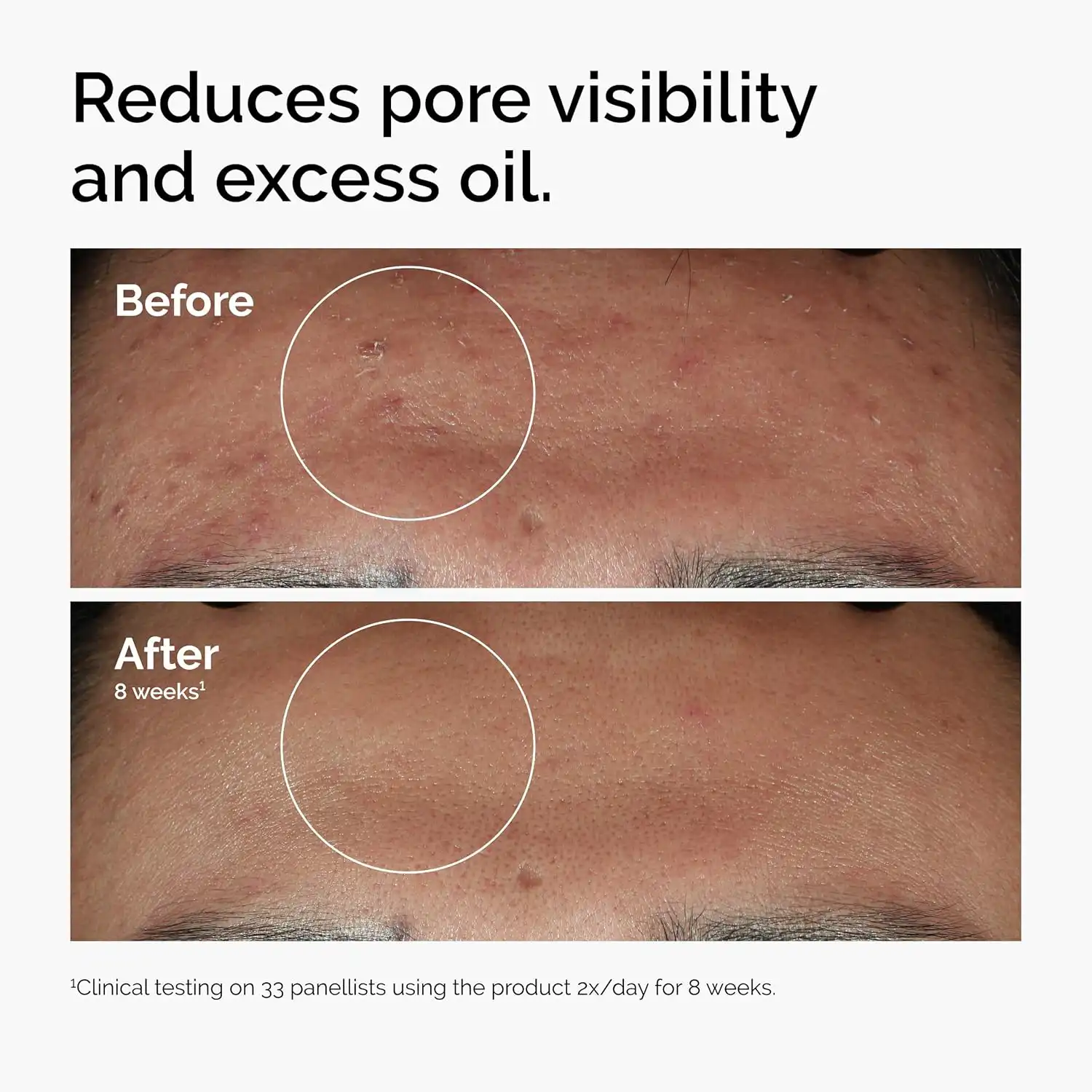 The Ordinary Niacinamide 10%+Zinc1% Mineral Serum-60ml thumbnail 5